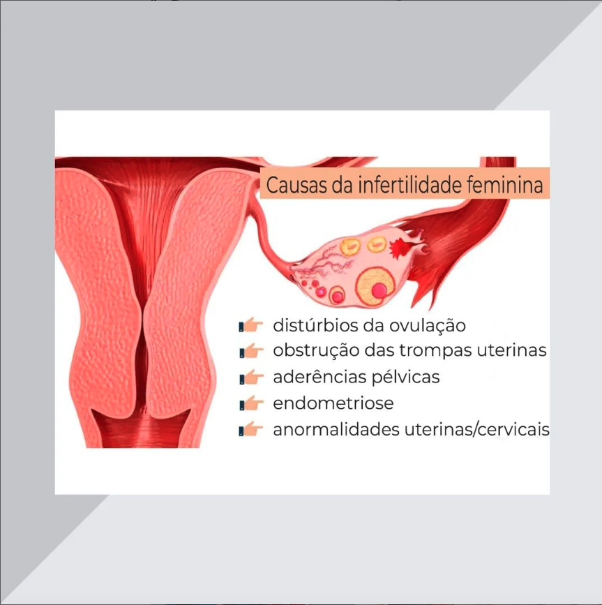 causas-da-infertilidade-feminina
