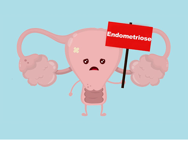 colicas-menstruais-muito-fortes-pode-ser-endometriose